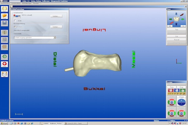 cerec-4