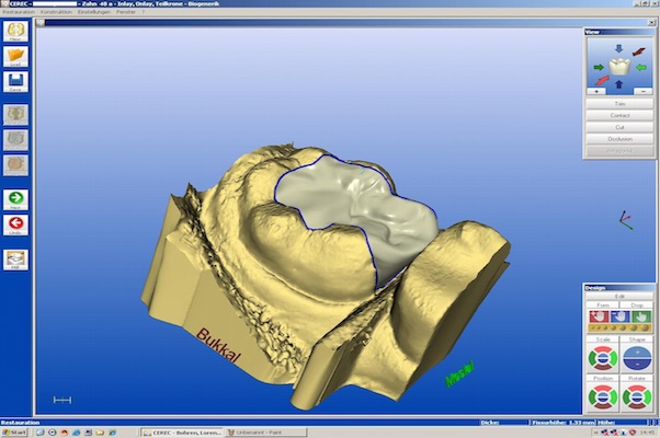 cerec-7