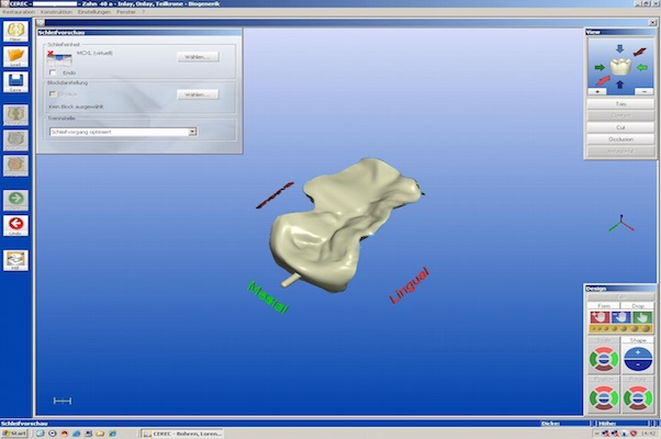 cerec-8