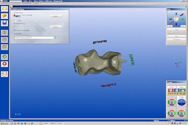 cerec-9