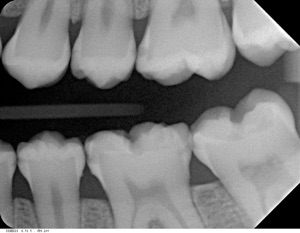 digitales-roentgen-3