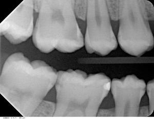 digitales-roentgen-4